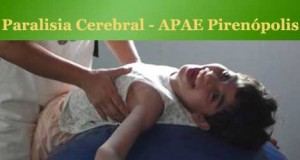 Paralisia Cerebral