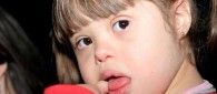 sindrome_de_down2 sindrome_de_down2